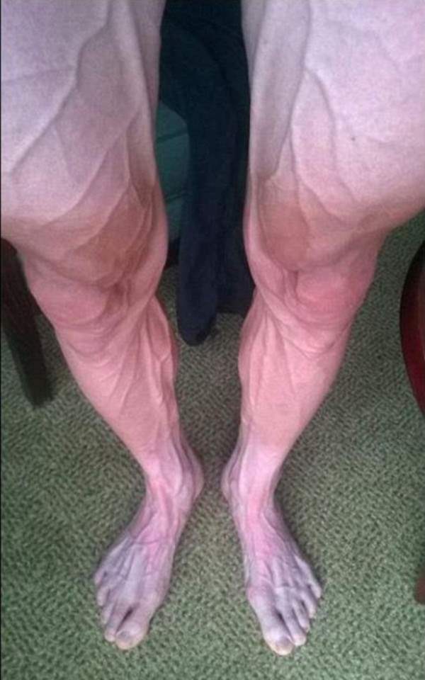This picture of Tour de France competitor Bartosz Huzarski's legs is incredible