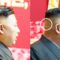 Ким Чен Ын, Северная Корея, затылок, пятно, травма,